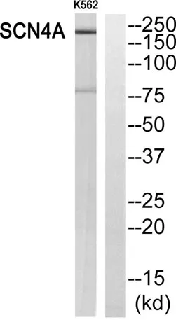 Na+ CP type IVα rabbit pAb - image 1