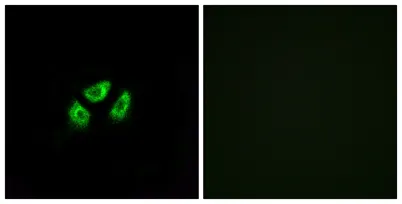 Na+ CP type VIIα rabbit pAb - image 1