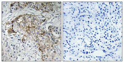 ENaC β (phospho Thr615) rabbit pAb - image 1