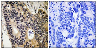 ENaC β rabbit pAb