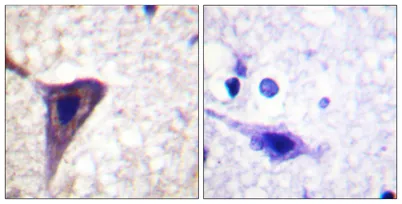 BID (phospho Ser78) rabbit pAb - image 1