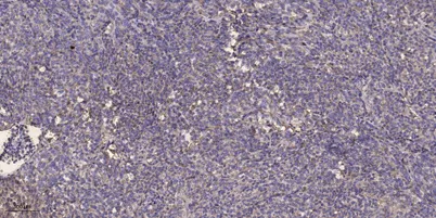 Serine racemase rabbit pAb - image 1