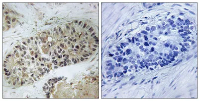 Artemis (phospho Ser516) rabbit pAb - image 1
