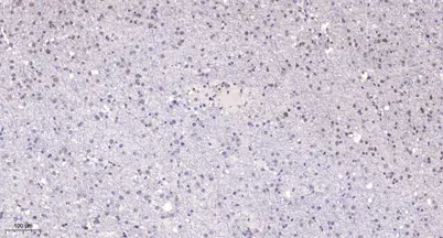 POLR1E rabbit pAb - image 1