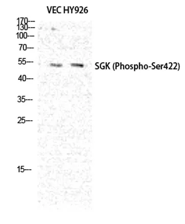 SGK1 (phospho Ser422) rabbit pAb - image 1