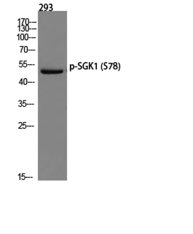 SGK1 (phospho Ser78) rabbit pAb - image 1