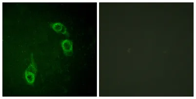 APC1 rabbit pAb - image 1