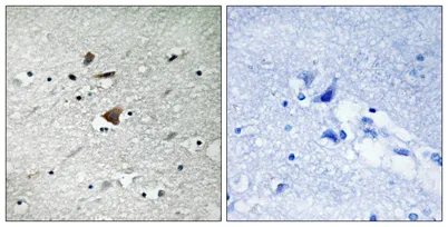 APC1 rabbit pAb - image 1