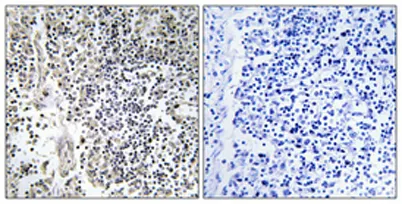 p47-phox (phospho Ser304) rabbit pAb - image 1