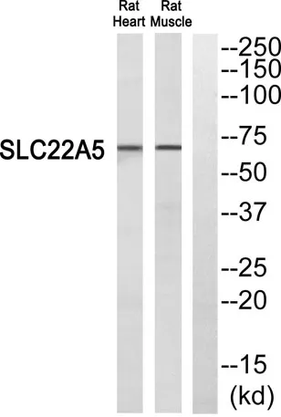 OCTN2 rabbit pAb - image 1