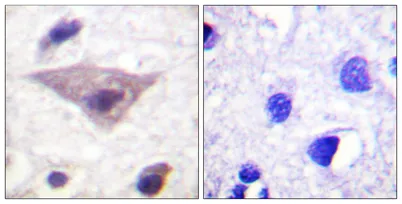 Synuclein-α (phospho Ser129) rabbit pAb - image 1