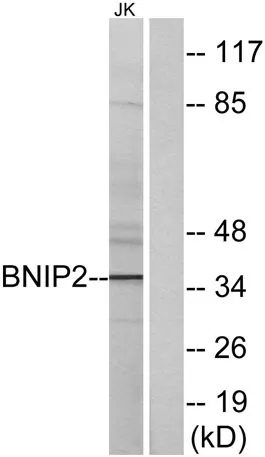 BNIP-2 rabbit pAb - image 1