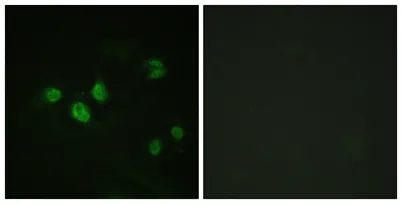 Sp1 (phospho Thr453) rabbit pAb