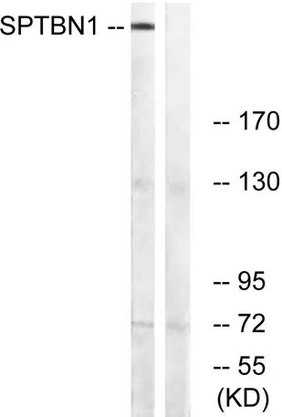 Spectrin β II rabbit pAb - image 1