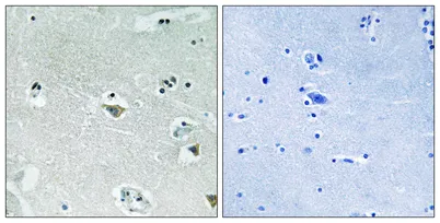 SREBP-1 (phospho Ser439) rabbit pAb - image 1