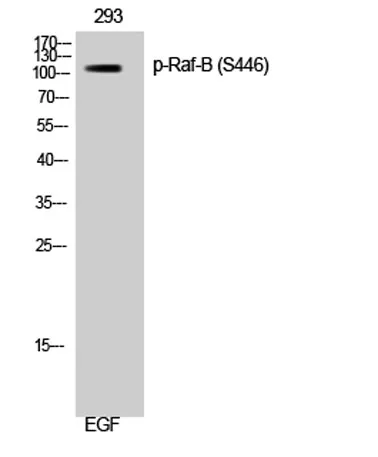 Raf-B (phospho Ser446) rabbit pAb - image 1