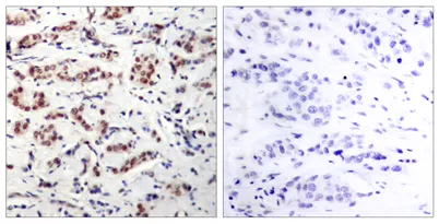 Stat5 (phospho Tyr694/699) rabbit pAb