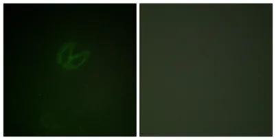 Syk (phospho Tyr323) rabbit pAb - image 1