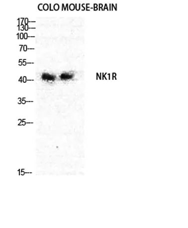 NK-1R rabbit pAb - image 1