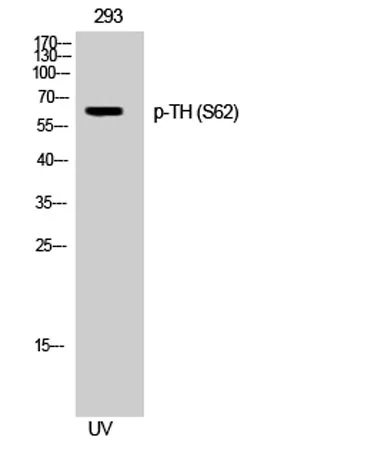 TH (phospho Ser62) rabbit pAb - image 1