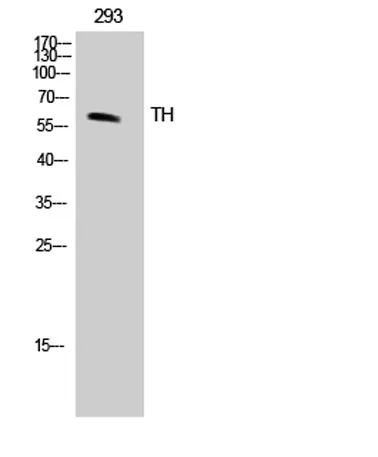 Tyrosine Hydroxylase rabbit pAb - image 1