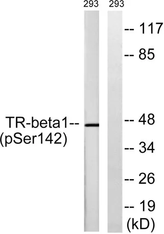 TRβ1 (phospho Ser142) rabbit pAb - image 1