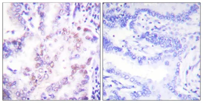 TRβ1 rabbit pAb