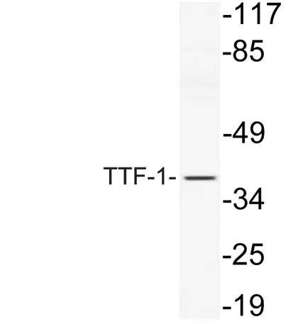 TTF-1 rabbit pAb - image 1