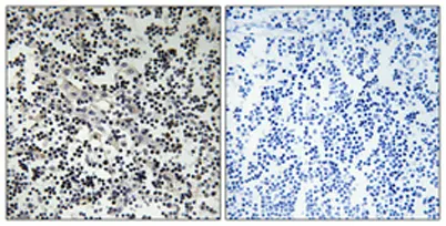 Thymidine Kinase rabbit pAb - image 1