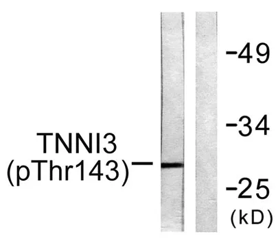 Troponin I-C (phospho Thr142) rabbit pAb - image 1