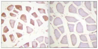 Troponin I-C rabbit pAb - image 1