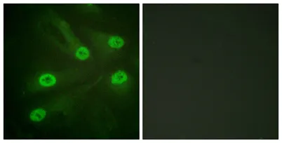 Acetyl p53 (K386) rabbit pAb