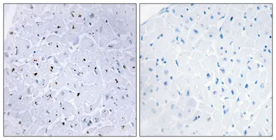 53BP1 (phospho Ser6) rabbit pAb - image 1