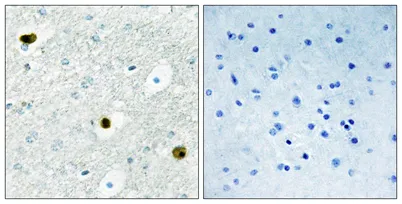TPD52 rabbit pAb - image 1