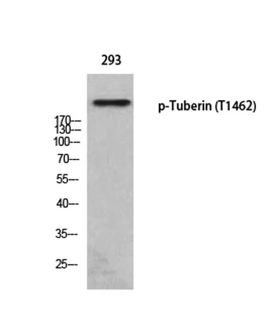 Tuberin (phospho Thr1462) rabbit pAb - image 1
