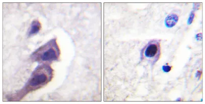 Tuberin rabbit pAb - image 1