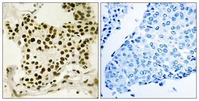 UBF (phospho Ser484) rabbit pAb