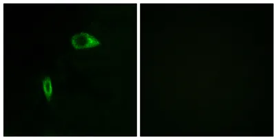 COL14A1 rabbit pAb - image 1