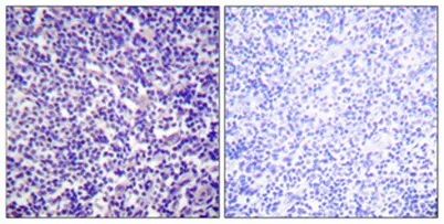 VASP (phospho Ser157) rabbit pAb - image 1