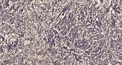 VASP (phospho Thr278) rabbit pAb - image 1