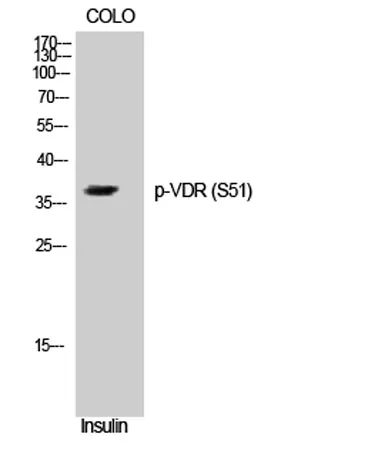 VDR (phospho Ser51) rabbit pAb - image 1