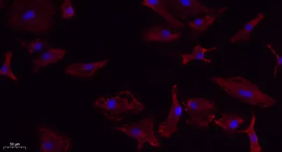 VEGF-A rabbit pAb - image 1