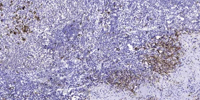 VHL (phospho Ser68) rabbit pAb