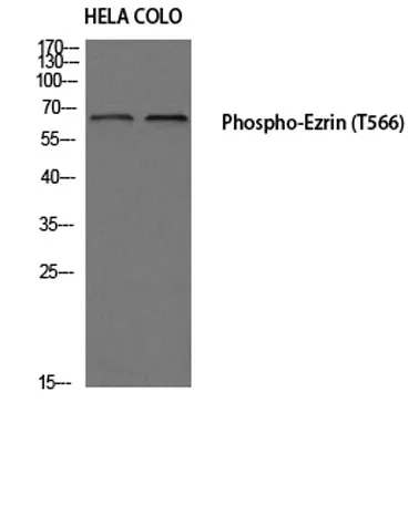 Ezrin (phospho Thr566) rabbit pAb - image 1