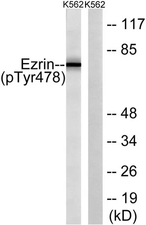 Ezrin (phospho Tyr478) rabbit pAb - image 1