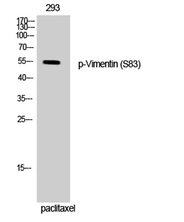 Vimentin (phospho Ser83) rabbit pAb