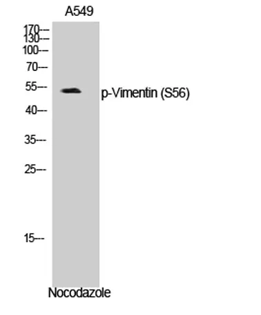 Vimentin (phospho Ser56) rabbit pAb - image 1
