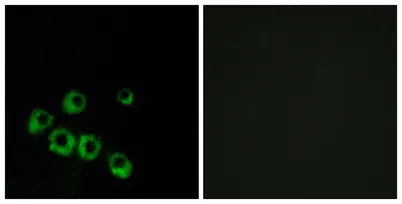 VPAC1 rabbit pAb - image 1
