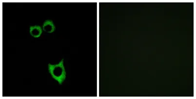VPAC2 rabbit pAb - image 1