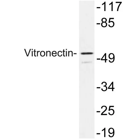 Vitronectin rabbit pAb - image 1